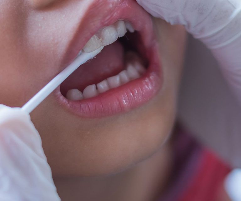 Fluoride